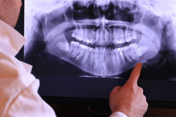 Best Urgent Dental Care for Toothache in Mountain Park, GA